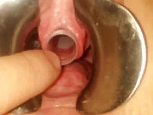 Wunderbare kostenlos ...